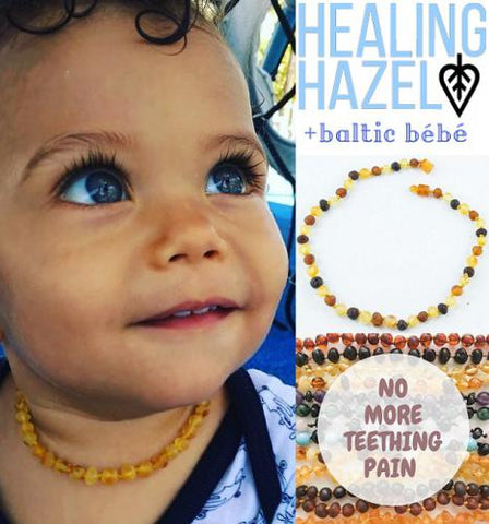 Healing Hazel Baltic Amber Necklaces 11"