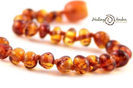 Healing Baltic Amber 13" Necklace (2-4 years)